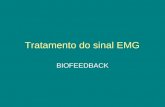 Tratamento do sinal EMG