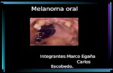 Melanoma oral