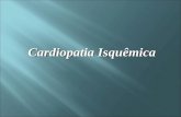 Cardiopatia Isquêmica