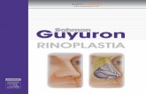 Siga as técnicas e dicas do mestre Guyuron em todas as aplicações da rinoplastia.