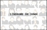 SÍNDROME DE DOWN. A Síndrome de Down ou Trissomia do Cromossomo 21, foi a primeira alteração cromossômica clinicamente definida. 1866 - John Langdon Down.1866.