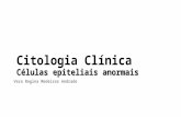 Células epiteliais anormais Citologia Clínica Células epiteliais anormais Vera Regina Medeiros Andrade.