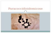 Paracoccidioidomicose. Etiologia/Epidemiologia “Uma mycose pseudococcidica localisada na bocca e observada no Brazil. Contribuição ao conhecimento das.