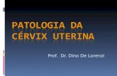 Prof. Dr. Dino De Lorenzi. Câncer do colo uterino  Problema de Saúde Pública mundial - 3º Mundo  2ª neoplasia genital feminina Brasil  450.000 novos.