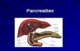 Pancreatites. Pancreatite aguda Século XII 1889 – primeira publicação (supurativa, hemorrágica, gangrenosa) 1901 – pancreatite necro-hemorrágica (autópsia)