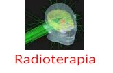Radioterapia. A radioterapia é um método capaz de destruir células tumorais, empregando feixe de radiações ionizantes. Uma dose pré-calculada de radiação.