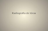 Radiografia de tórax. + utilizados Custo Objetivos da aula de hoje.