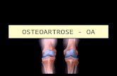 OSTEOARTROSE - OA. Sinonímia Osteoartrite Osteoartrose Doença articular degenerativa Artrite hipertrófica Artrite deformante Artrose condromalácia.