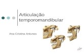 Ana Cristina Antunes Articulação temporomandibular.