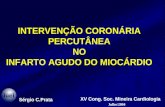 INTERVENÇÃO CORONÁRIA PERCUTÂNEA NO INFARTO AGUDO DO MIOCÁRDIO Sérgio C.Prata XV Cong. Soc. Mineira Cardiologia Julho/2004.