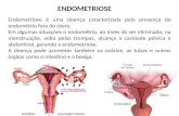 Endometriose é uma doença caracterizada pela presença de endométrio fora do útero. Em algumas situações o endométrio, ao invés de ser eliminado, na menstruação,
