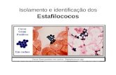Isolamento e identificação dos Estafilococos. Importância Clínica dos Estafilococos Staphylococcus aureus Intoxicação alimentar (produção de enterotoxinas)