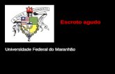 Universidade Federal do Maranhão Escroto agudo. Definição Síndrome clínica caracterizada por aumento súbito e doloroso da bolsa escrotal provocado por.
