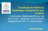 Evolução Radiográfica da Artrite: Doença articular degenerativa e Variações. Nicholas Godoy.