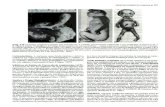 Embriologia - Capítulos 9 Ao 15