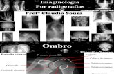 Aula 2 - Imaginologia por radiografias. Ombro e cintura escapular. Profº Claudio Souza