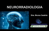 Neurorradiologia anatomia e AVCI