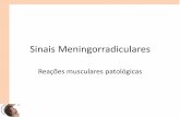 Sinais meningorradiculares 15