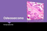 04   aula - osteossarcoma