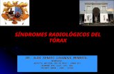 Síndromes radiológicos del tórax