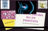 Adenocarcinoma De Próstata