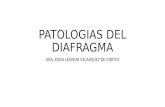 Patologias del diafragma