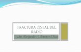 Fracturas distal del radio