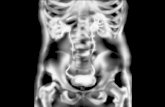 Fisiologia do Sistema Urinário - censa.edu.br Urinário-3.pdf · distintas: o túbulo contorcido proximal, a alça néfrica (ou de Henle) e o túbulo contorcido distal. Este último