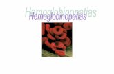 O que são as hemoglobinopatias ? - Einstein Limeira · a a globina alfa livre; (3) Hb AA2 e Fetal em tal. beta menor; (4) Hb AS (traço falciforme); (5) Hb AA (normal). Cadeias ...