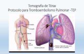 Tomografia de Tórax Protocolo para …claudiosouza.org/portal/wp-content/uploads/2015/10/PROTOCOLO-PA… · Tromboembolismo Pulmonar Definição: O tromboembolismo Pulmonar –TEP