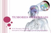 TUMORES CEREBRAIS - downloadportal.sereduc.com · -Caracterizam-se por alterações na secreção hormonal. CLASSIFICAÇÃO DOS TUMORES