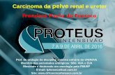 Carcinoma da pelve renal e ureter - RV Mais Promoção e ...rvmais.com.br/homologacao/proteus/2016/aulas/09-04/09-04 - 15H00... · (eGFR < 30ml/min/1,73m2): fibrose nefrogênica Carcinoma