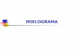 MIELOGRAMA - cenapro.com.br · Roteiro Noções gerais ... JUNTA COM OS ACHADOS DO HEMOGRAMA (de preferência o sangue periférico deve ser colhido no mesmo dia da coleta do mielograma)