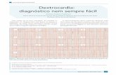 Dextrocardia: diagnóstico nem sempre fácilfiles.bvs.br/upload/S/1413-9979/2014/v19n4/a4357.pdf · do coração, que é o deslocamento do coração para o he-mitórax direito, devido