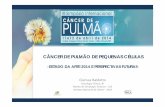 CÂNCER DE PULMÃO DECÂNCER DE PULMÃO DE …rvmais.com.br/simposio-internacional-pulmao/aulas/12-04/14H50-15H... · CÂNCER DE PULMÃO DECÂNCER DE PULMÃO DE PEQUENAS CÉLULAS