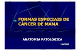 FORMAS ESPECIAIS DE CÂNCER DE MAMA - Laboratório … · formas especiais de cÂncer de mama anatomia patolÓgica locus . carcinomas produtores de mucina ... carcinoma de cÉlulas