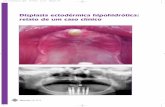 Displasia ectodérmica hipohidrótica: relato de um caso clínicodentalface.net/images/artigos/Displasia.pdf · Pós-graduado em Ortodontia pela Universidade de Nova Iorque (NYU).