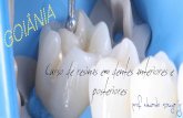 Curso de resinas em dentes anteriores e posteriores - Goiâniavitaeodontologia.com.br/wp-content/uploads/2017/02/curso-resina... · - Técnicas de estratificação com resinas compostas