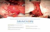 Revista de Angiologia e de Cirurgia Vascular n.¢› 1 ... Revista de Angiologia e de Cirurgia Vascular