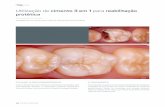 Utilização de cimento 3 em 1 para reabilitação protética · 2018-08-01 · 100 VOLUME 19 | FGM NEWS A QUEIXA Paciente do sexo masculino, 41 anos. Dente 36 com restauração fraturada.