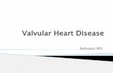 Valvular Heart Disease - Srinakharinwirot UniversityValvular Heart Disease Nattapun MD. 2 Atrioventricular (AV) valves Mitral valve Tricuspid valve 2 Semilunar valves Aortic valve