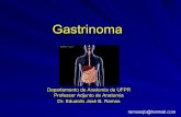 Gastrinoma - Dr. Eduardo Ramos · – 2/3 nível entre 150 e 1000 pg/ml – Nível >1000 → Dx praticamente confirmado Acloridria (anemia perniciosa e gastrite atrófica) podem facilmente