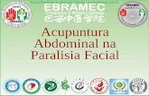 Acupuntura Abdominal na Paralisia Facial...O sistema de acupuntura abdominal foi idealizado pelo Dr. Bo Zhi Yun, onde estudou profundamente até que o sistema fosse desenvolvido, em