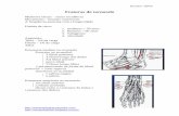 Fraturas do tornozelo · A ruptura do lig tibiofibular anterior pode ser pelo próprio ligamento,podendo avulsionar o osso onde ele se insere na tíbia distal(tubérculo de Chaput)