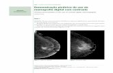 DOI: 10.5327/Z201500010006RBM Demonstração pictórica do ...€¦ · Demonstração pictórica do uso da mamografia digital com contraste 27 Descrição da mamografia Distorção
