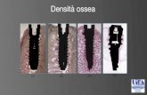 Densità ossea - OMCeO · (Misch 1990) Ribeiro-Rotta RF, Lindh C, Pereira AC, Rohlin M. Ambiguity in bone tissue characteristics as presented in studies on dental implant planning