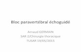 Bloc%paravertébral%échoguidé%...Ultrasound-guided thoracic paravertebral puncture and placement of catheters in human cadavers: where do catheters go? C. Luyet 1, G. Herrmann2,