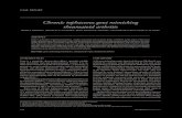 Chronic tophaceous gout mimicking rheumatoid …...Chronic tophaceous gout mimicking rheumatoid arthritis Bras J Rheumatol 2009;49(6):741-6 745 Physical exam of the locomotor system