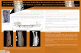 Osteomielite femoral num indivíduo exumado da …...Miguel church (Castelo Branco, Portugal): differential palaeopathological diagnosis. International Journal of Osteoarchaeology,