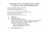 Espectro Cutáneo del Lupus Eritematosoantoniorondonlugo.com/wp-content/uploads/2010/05/66-Lupus.pdf · 3) Lupus Eritematoso Cutáneo Agudo (LECA) 3 Epidemiología El LE en general